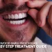 Hollywood Smile Procedure Step By Step Treatment Guide kapak