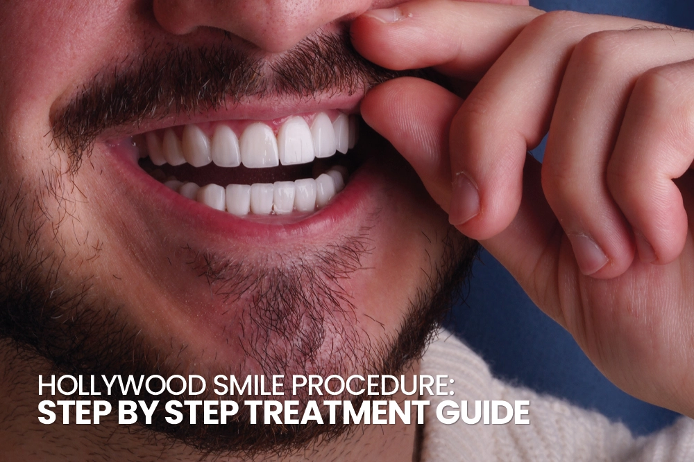 Hollywood Smile Treatment Procedure