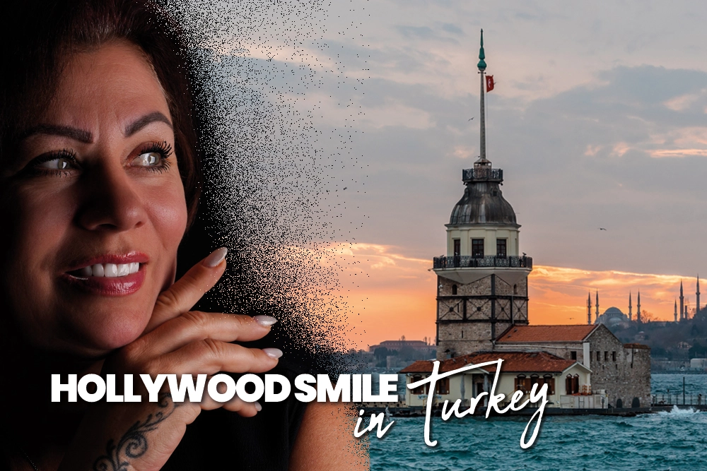 Hollywood Smile in Turkey