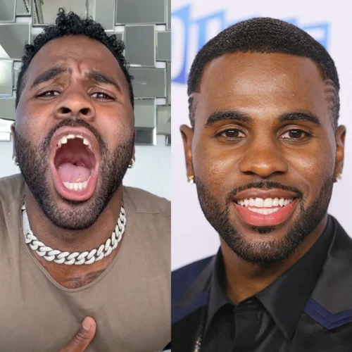 Jason Derulo Before and After