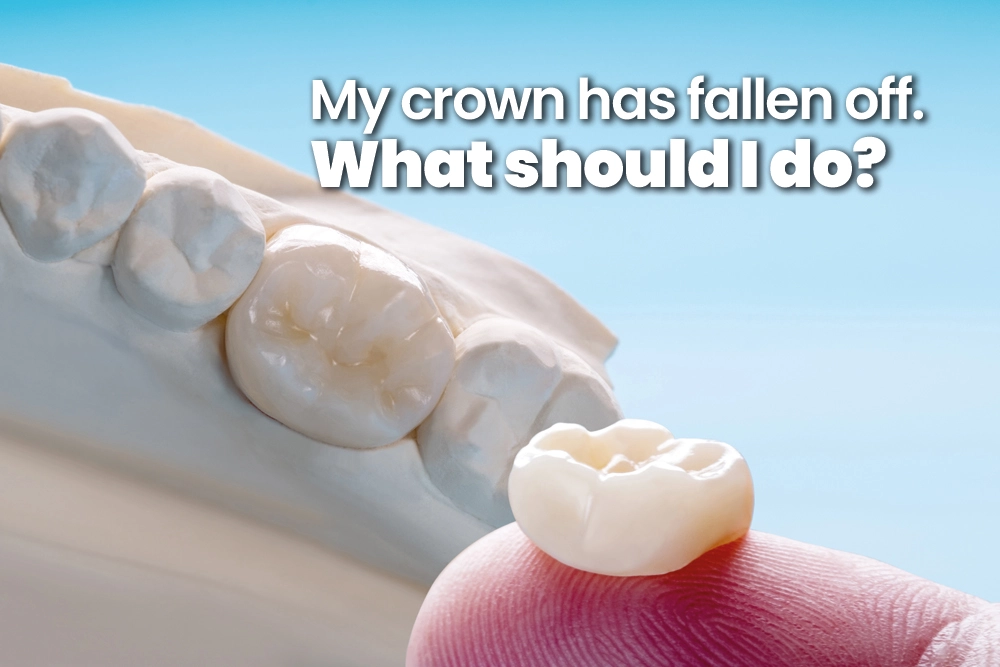 My Crown Has Fallen Off. What Should I Do?
