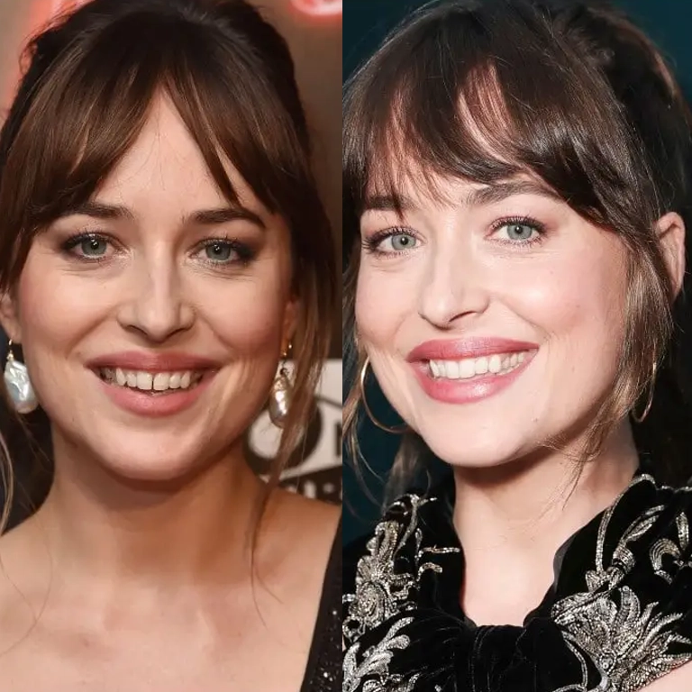 The Impact of Retainer Removal on Dakota Johnson's Teeth