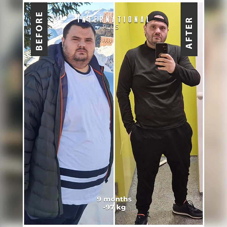 Treating Obesity