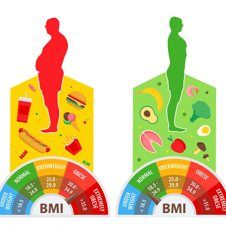 What Causes Obesity