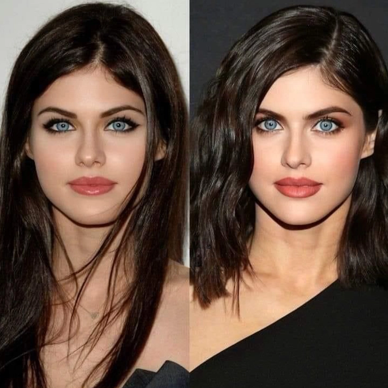 Alexandra Daddario Botox