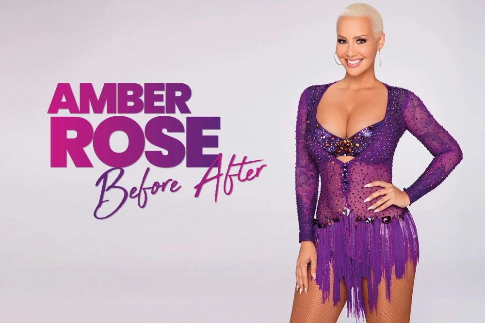 Amber Rose Before After