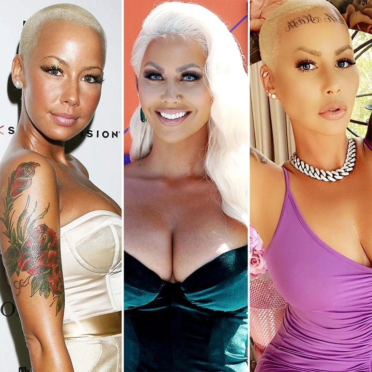 Amber Rose Breast Augmentation