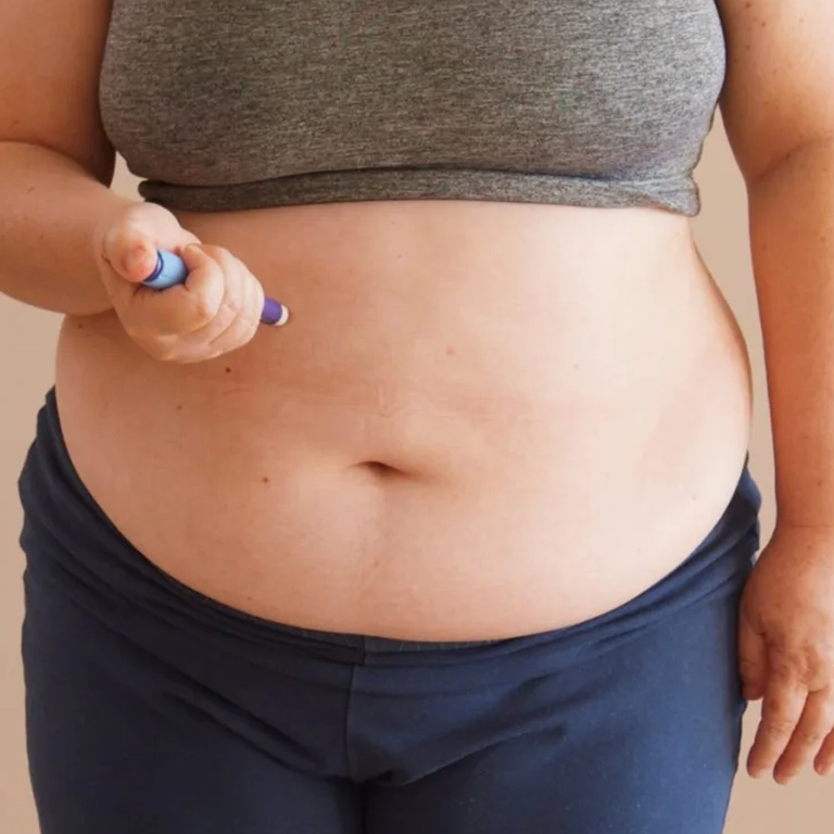 Bariatric Surgery for Obesity