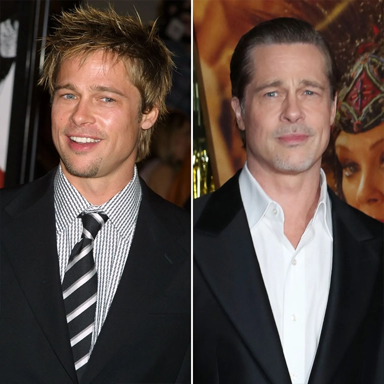 Brad Pitt Anti Aging Treatments