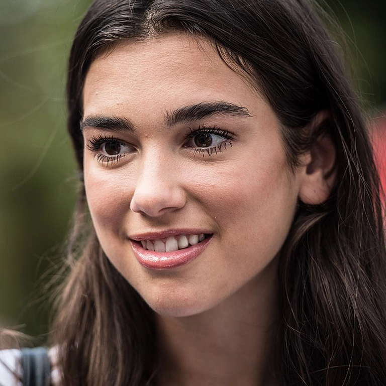 Dua Lipa Before and After Veneers