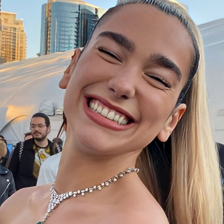 Dua Lipa Teeth Before and After