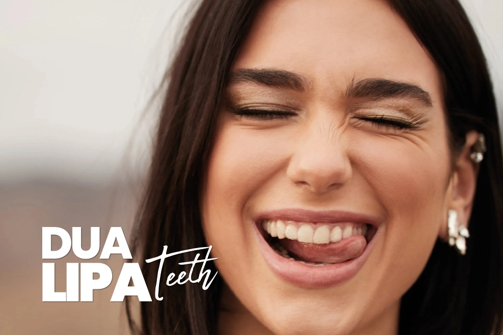 Dua Lipa Teeth
