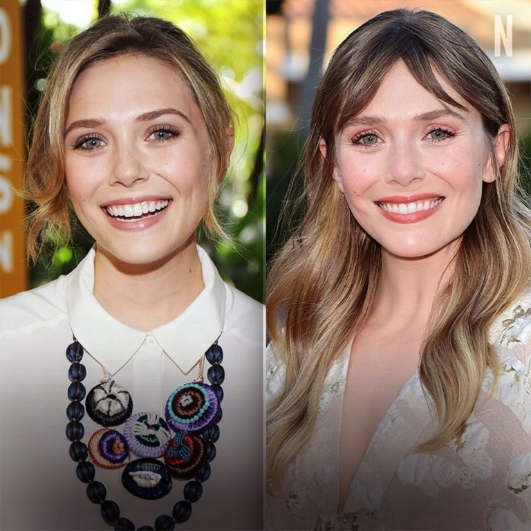 Elizabeth Olsen Botox