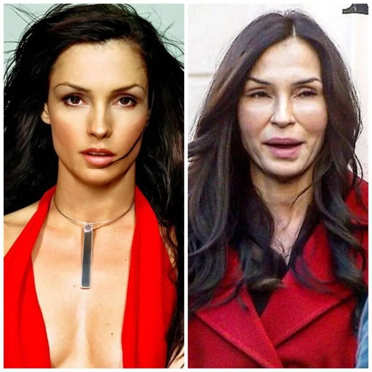 Famke Janssen Cosmetic Procedures