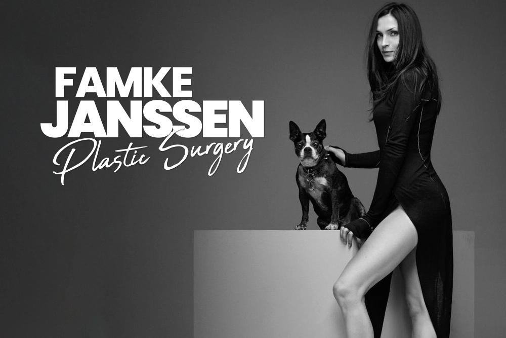 Famke Janssen Plastic Surgery