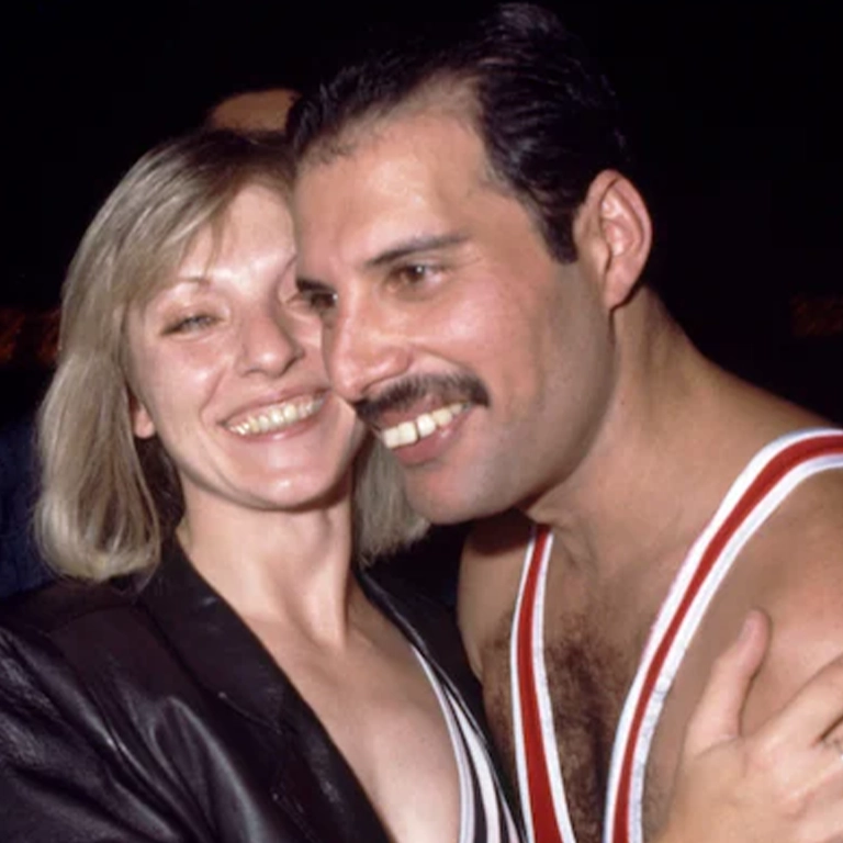 Freddie Mercury Tooth Shape Improvement
