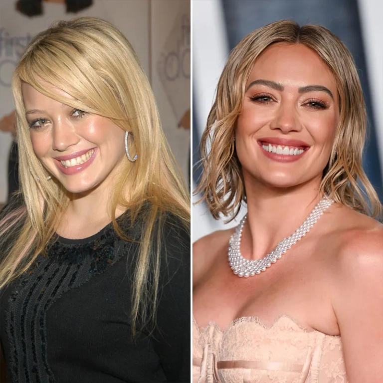Hilary Duff Dental Aesthetics