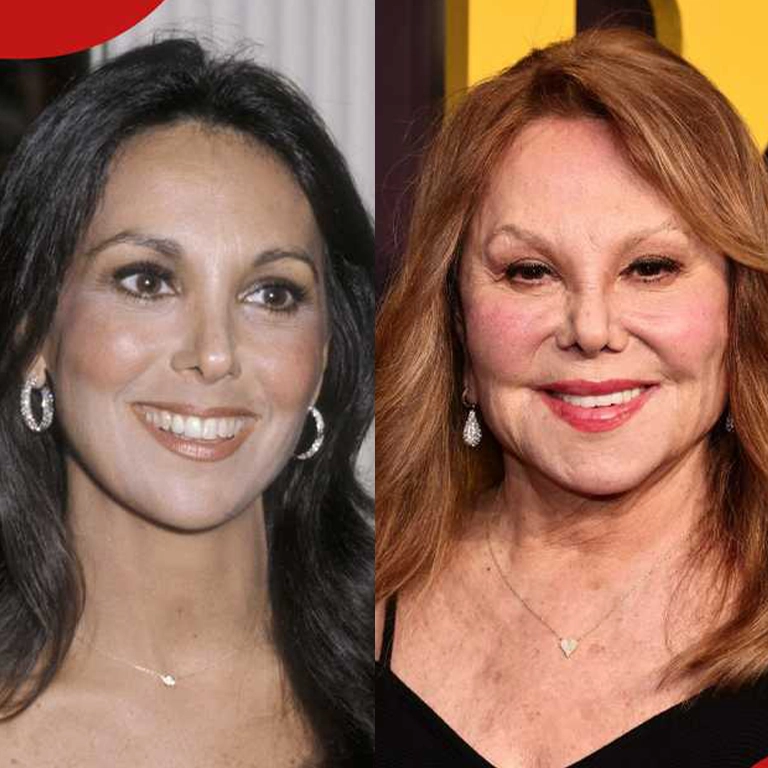 Marlo Thomas Cosmetic Procedures