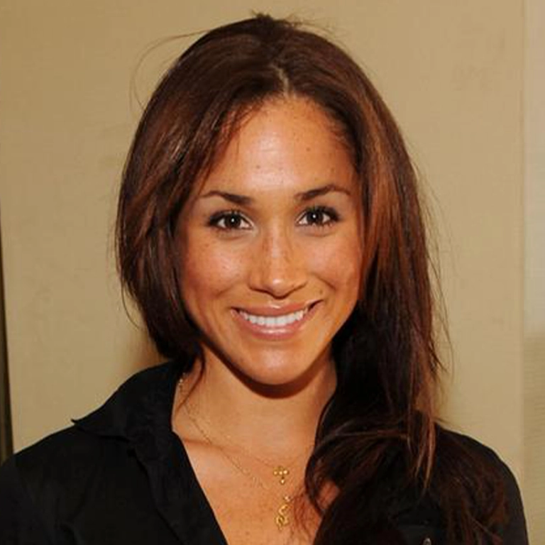 Meghan Markle Cosmetic Dentistry