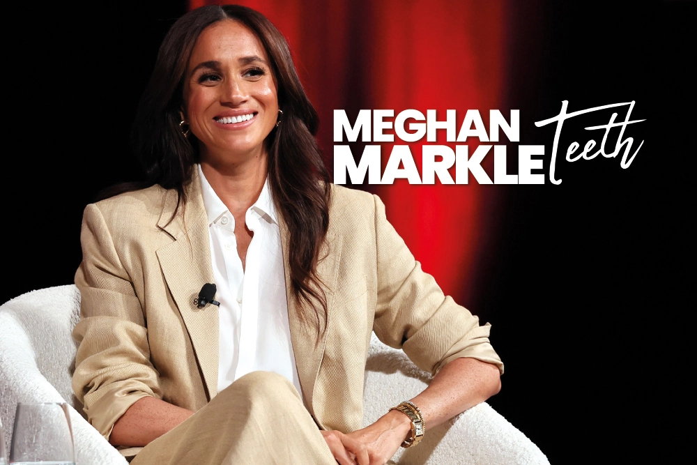 Meghan Markle Teeth