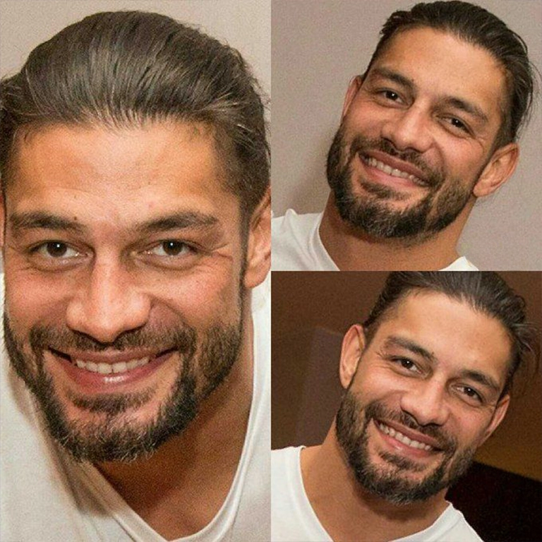 Roman Reigns Cosmetic Dentistry
