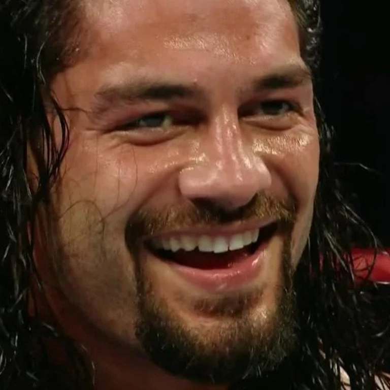 Roman Reigns Dental Aesthetics