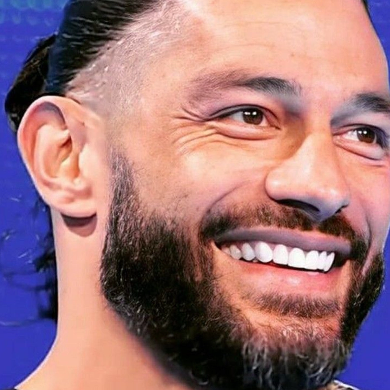 Roman Reigns Porcelain Veneers