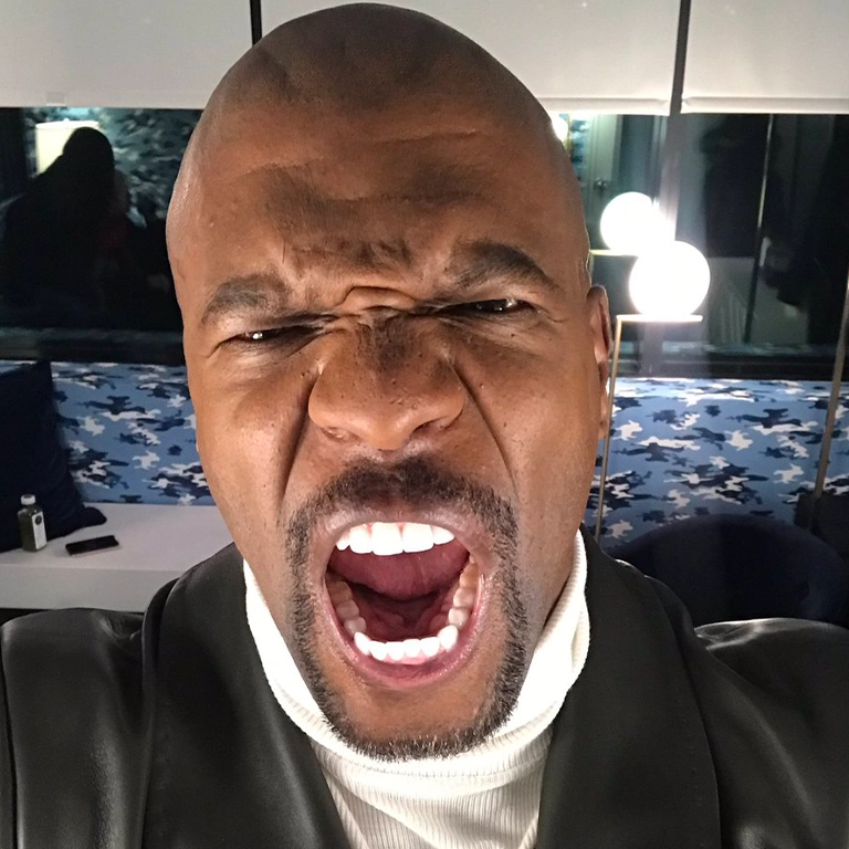 Terry Crews Hollywood Smile Makeover