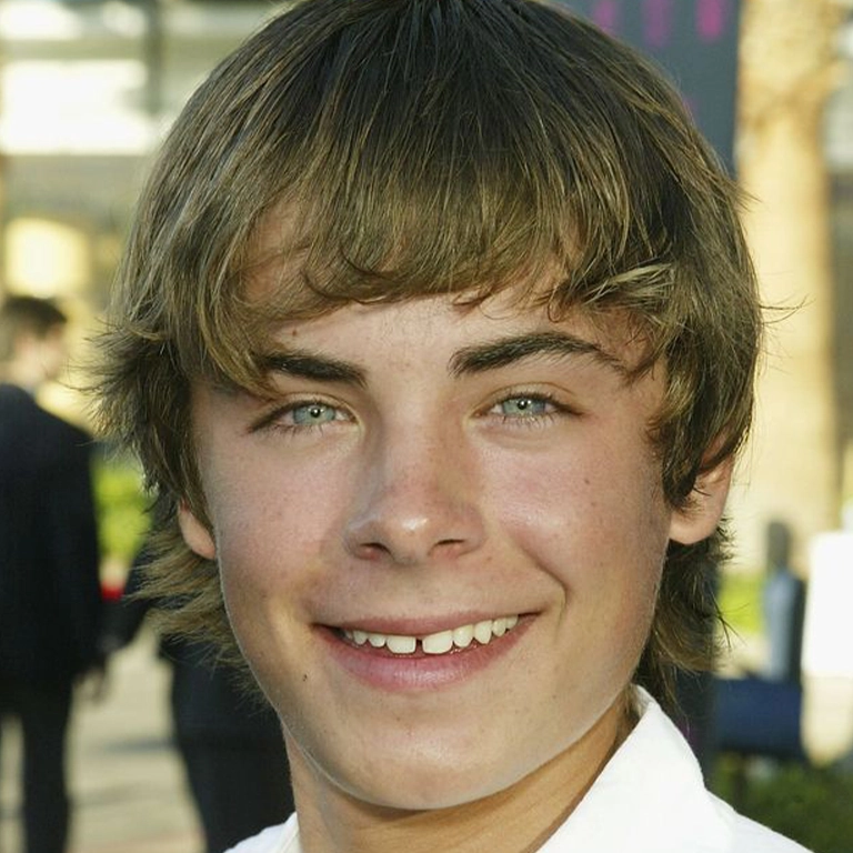 Zac Efron Teeth Transformation