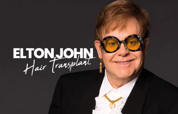 Elton John Hair Transplant