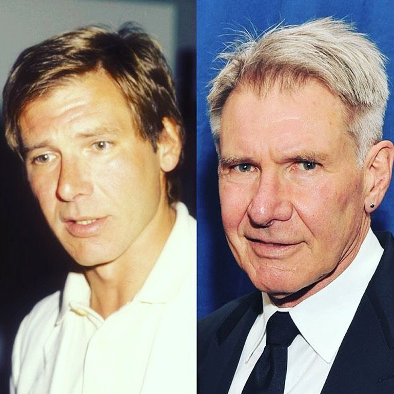 Harrison Ford Nose Job