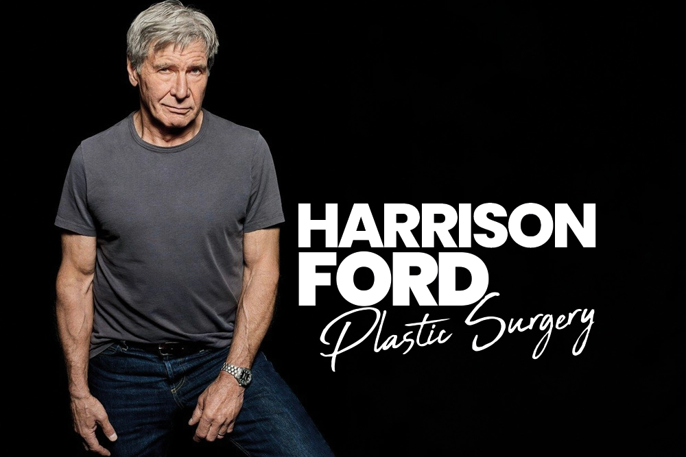 Harrison Ford Plastic Surgery