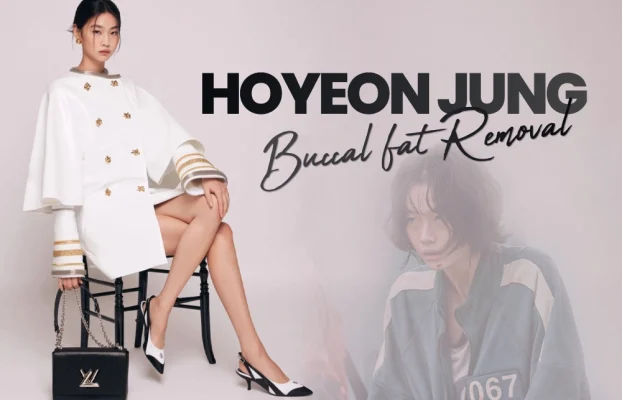 HoYeon Jung Buccal Fat Removal