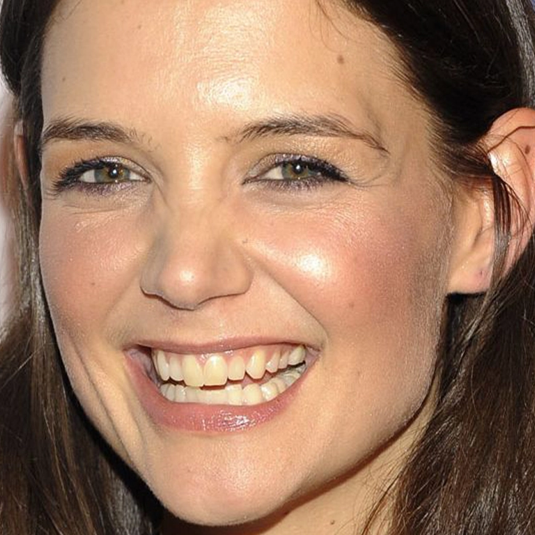 Katie Holmes Porcelain Veneers