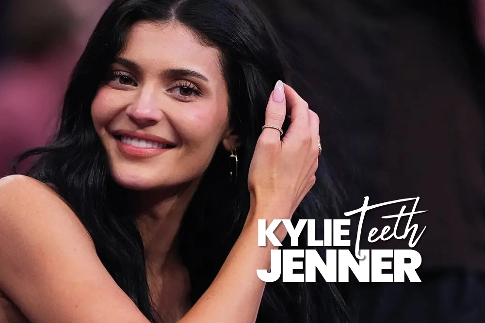 Kylie Jenner Teeth