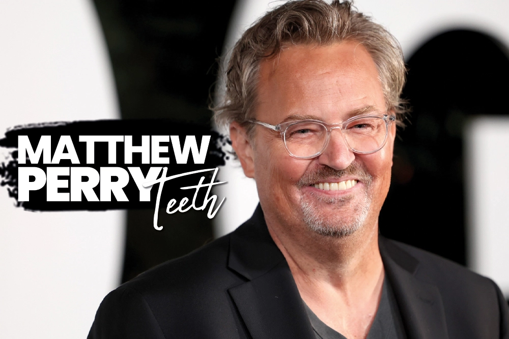 Matthew Perry Teeth