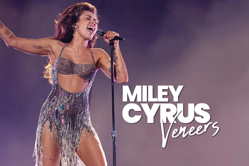 Miley Cyrus Veneers