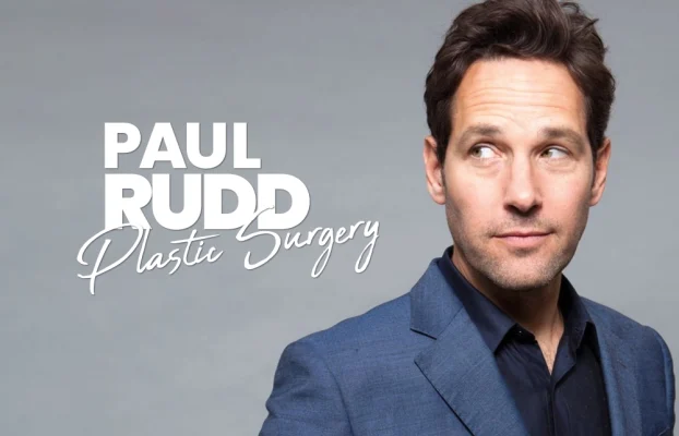 Paul Rudd Plastic Surgery
