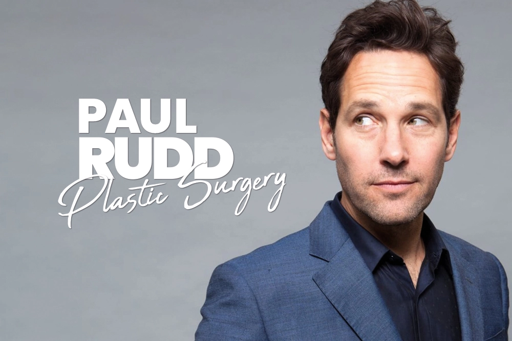 Paul Rudd Plastic Surgery