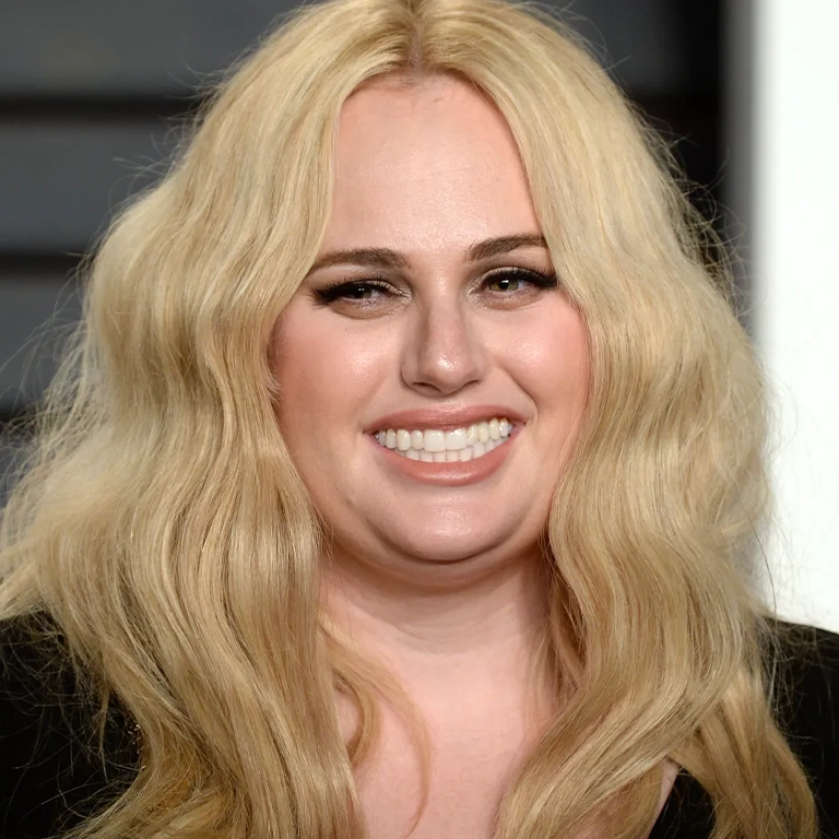Rebel Wilson Porcelain Veneers