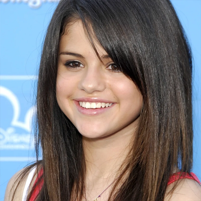Selena Gomez Teeth Transformation