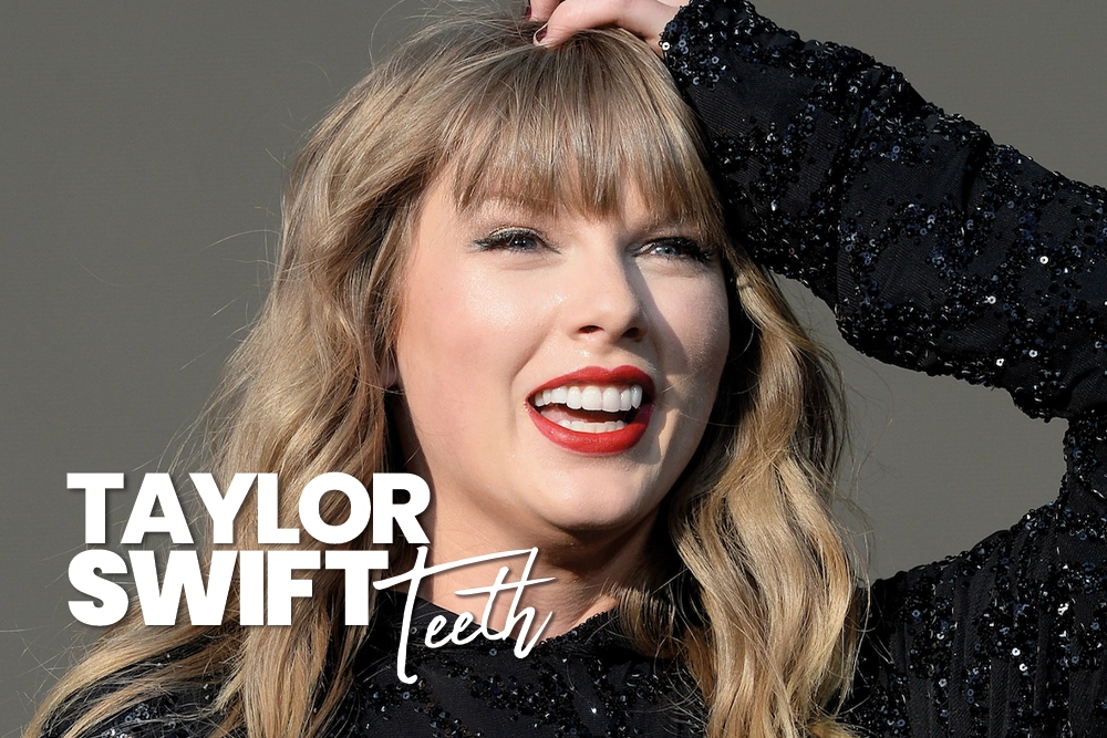 Taylor Swift Teeth
