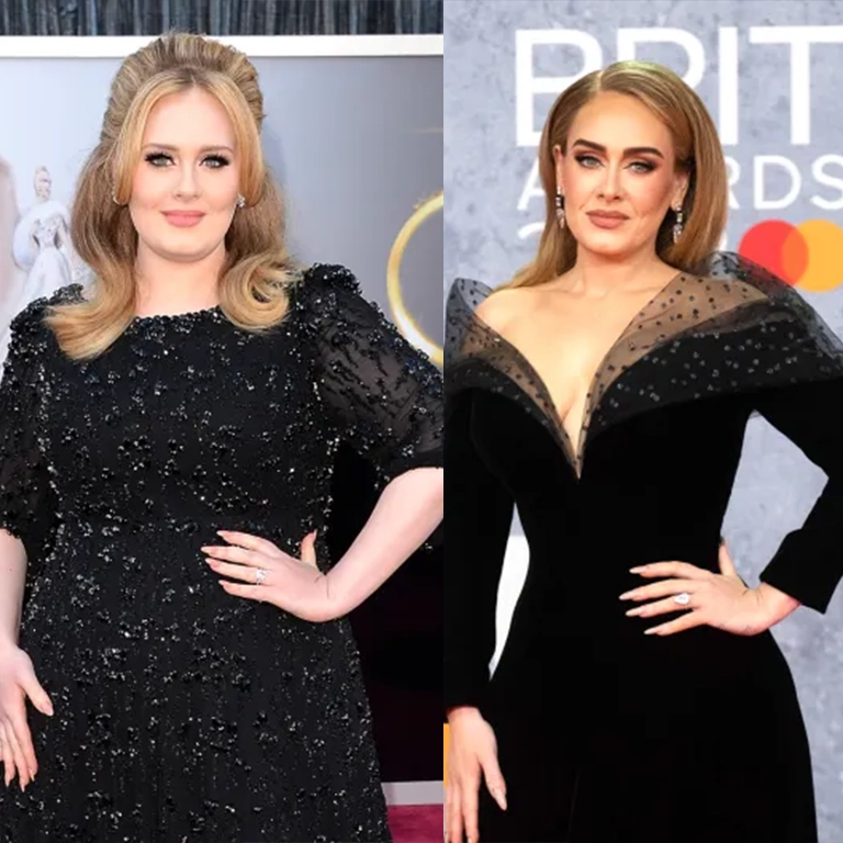 Adele Before and After Surgery