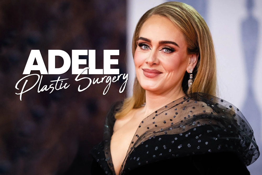 Adele Plastic Surgery