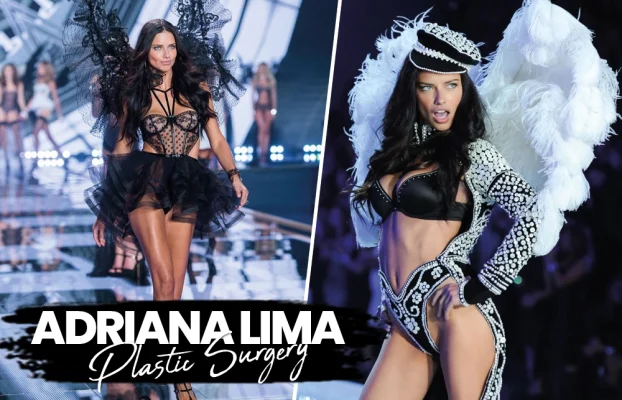 Adriana Lima Plastic Surgery