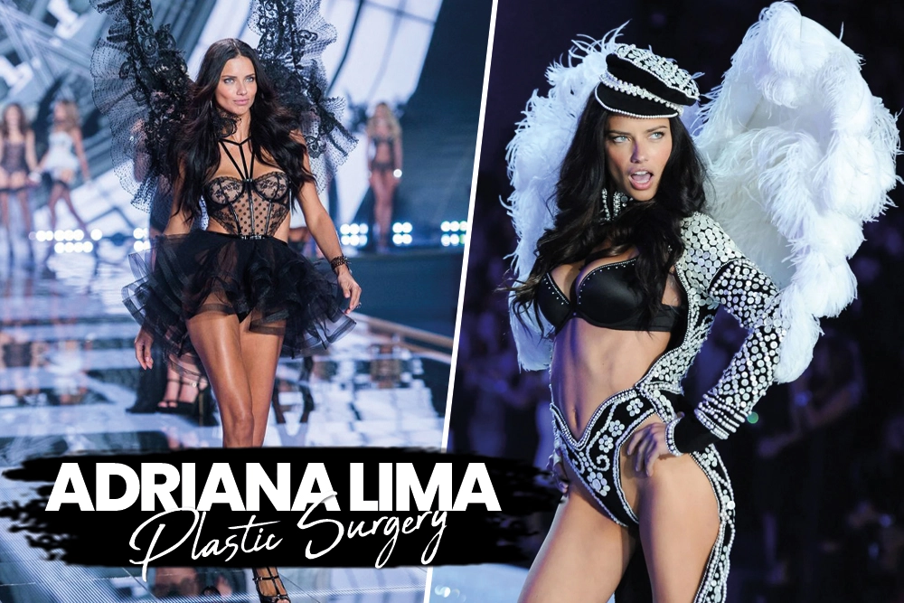 Adriana Lima Plastic Surgery