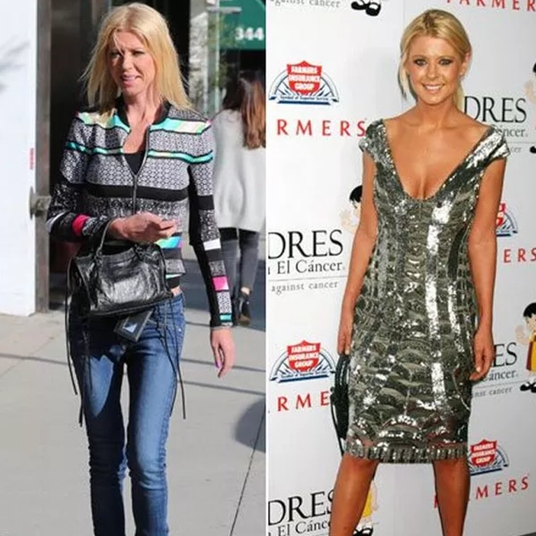 Body Contouring Procedures to Get a Figure Like Tara Reid