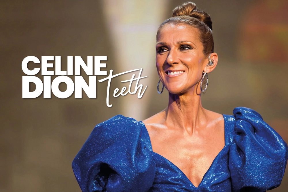Celine Dion Teeth