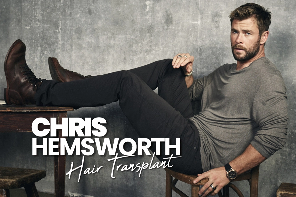 Chris Hemsworth Hair Transplant