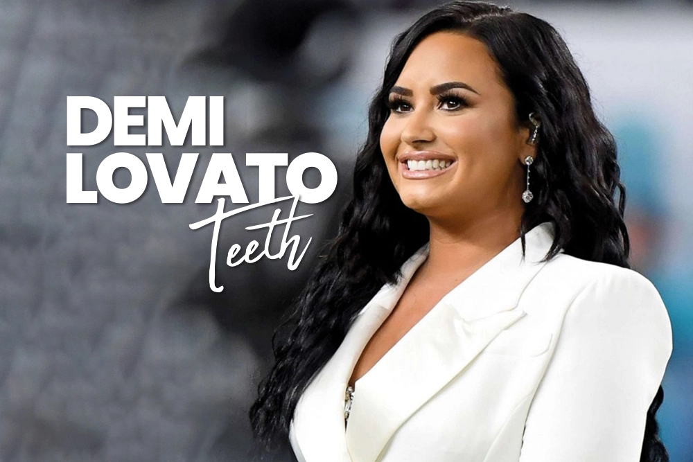 Demi Lovato Teeth